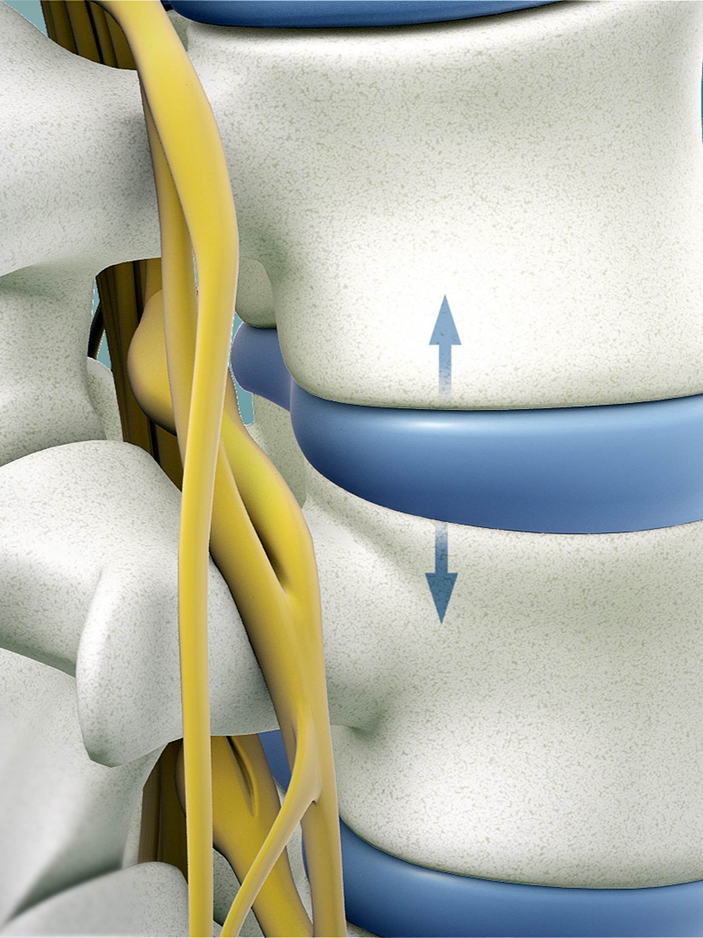 Spinal_Decompression_2_1380X1840_250KB - Chiropractor in San Mateo | Quarneri Chiropractic | Accepting New Patients