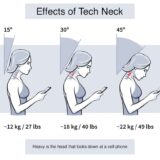 One of the best chiropractors in San Mateo, Dr. Paul Quarneri, demonstrates Forward Head Posture (FHP)